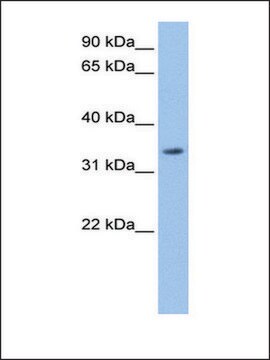 Anti-LACTB (AB1) antibody produced in rabbit affinity isolated antibody