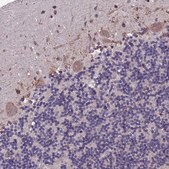 Anti-BTBD3 antibody produced in rabbit Prestige Antibodies® Powered by Atlas Antibodies, affinity isolated antibody, buffered aqueous glycerol solution