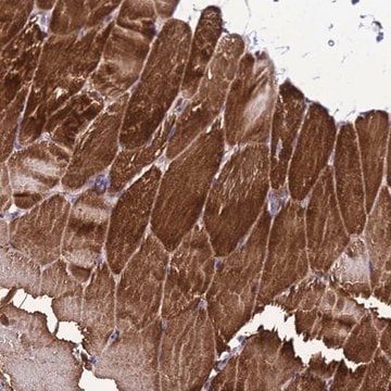 Anti-GZF1 antibody produced in rabbit Prestige Antibodies&#174; Powered by Atlas Antibodies, affinity isolated antibody, buffered aqueous glycerol solution