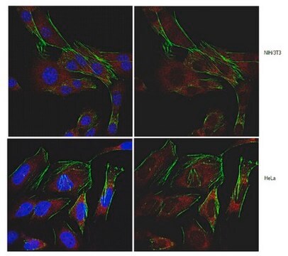 Anti-SDHD (CybS) Antibody from rabbit, purified by affinity chromatography