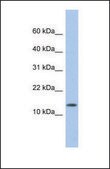 Anti-ID2 antibody produced in rabbit affinity isolated antibody