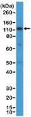 Anti-CD30 Rabbit Monoclonal Antibody clone RM425, affinity purified immunoglobulin