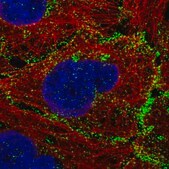 Monoclonal Anti-VANGL1 antibody produced in mouse Prestige Antibodies&#174; Powered by Atlas Antibodies, clone CL0241, purified immunoglobulin, buffered aqueous glycerol solution