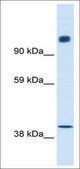 Anti-NCOR1 antibody produced in rabbit affinity isolated antibody