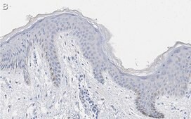 Anti-pan-cytokeratin Antibody, clone AE1 ZooMAb® Mouse Monoclonal recombinant, expressed in HEK 293 cells