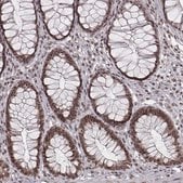 Anti-HMGA2 antibody produced in rabbit Prestige Antibodies&#174; Powered by Atlas Antibodies, affinity isolated antibody, buffered aqueous glycerol solution