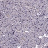Anti-ADAM11 Prestige Antibodies&#174; Powered by Atlas Antibodies, affinity isolated antibody