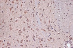 Anti-RanGAP1 antibody produced in rabbit