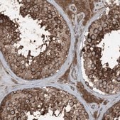 Anti-RAB3GAP1 antibody produced in rabbit Prestige Antibodies&#174; Powered by Atlas Antibodies, affinity isolated antibody, buffered aqueous glycerol solution