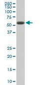 Monoclonal Anti-RIPK2 antibody produced in mouse clone 2C7, purified immunoglobulin, buffered aqueous solution