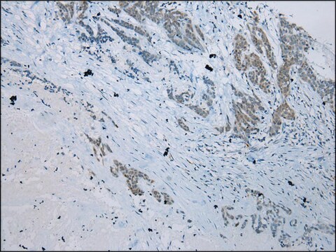 Anti-SERPINB11 affinity isolated antibody