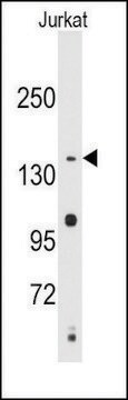 Anti-SULT1C2 (N-term) antibody produced in rabbit IgG fraction of antiserum, buffered aqueous solution