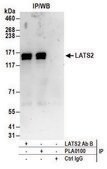 Rabbit anti-LATS2 Antibody, Affinity Purified Powered by Bethyl Laboratories, Inc.