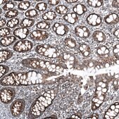 Anti-CXorf21 antibody produced in rabbit affinity isolated antibody, buffered aqueous glycerol solution