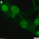 Anti-S100A4 Antibody, clone 1G2 ZooMAb&#174; Rabbit Monoclonal recombinant, expressed in HEK 293 cells