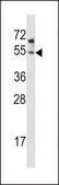 ANTI-ZDHHC6 (C-TERM) antibody produced in rabbit IgG fraction of antiserum, buffered aqueous solution