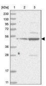 Anti-IL11RA antibody produced in rabbit Prestige Antibodies® Powered by Atlas Antibodies, affinity isolated antibody, buffered aqueous glycerol solution