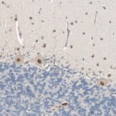 Anti-PSMD8 antibody produced in rabbit Prestige Antibodies&#174; Powered by Atlas Antibodies, affinity isolated antibody, buffered aqueous glycerol solution