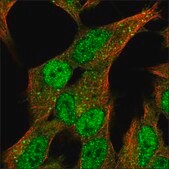 Anti-SV2C antibody produced in rabbit Prestige Antibodies® Powered by Atlas Antibodies, affinity isolated antibody, buffered aqueous glycerol solution