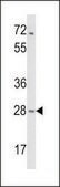 ANTI-HCCA2 (N-TERM) antibody produced in rabbit IgG fraction of antiserum, buffered aqueous solution