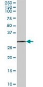 Anti-EXOSC3 antibody produced in mouse purified immunoglobulin, buffered aqueous solution