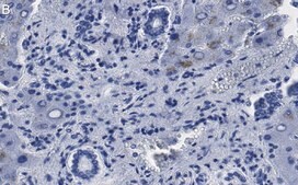 Anti-MeCP2 Antibody, clone 1L20 ZooMAb&#174; Rabbit Monoclonal recombinant, expressed in HEK 293 cells