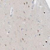 Anti-PAK6 antibody produced in rabbit Prestige Antibodies® Powered by Atlas Antibodies, affinity isolated antibody, buffered aqueous glycerol solution