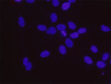 p53 and phospho-BRCA1[S1280] PLA® Antibody Kit Powered by Bethyl Laboratories, Inc.