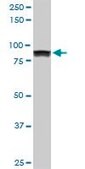 Monoclonal Anti-UBTF antibody produced in mouse clone 6C6, purified immunoglobulin, buffered aqueous solution
