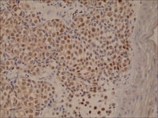 Anti-MUM1/IRF4 antibody, Rabbit monoclonal recombinant, expressed in HEK 293 cells, clone RM352, purified immunoglobulin