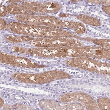 Anti-TMEM185A antibody produced in rabbit Prestige Antibodies&#174; Powered by Atlas Antibodies, affinity isolated antibody, buffered aqueous glycerol solution