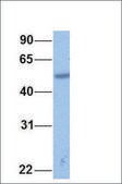 Anti-RARA antibody produced in rabbit affinity isolated antibody