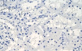 Anti-EBP/NHERF-1 Antibody, clone 1G10 ZooMAb&#174; Rabbit Monoclonal recombinant, expressed in HEK 293 cells