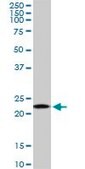Monoclonal Anti-RPS5, (C-terminal) antibody produced in mouse clone 3G3, purified immunoglobulin, buffered aqueous solution