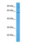 Anti-IGF2BP1 antibody produced in rabbit affinity isolated antibody