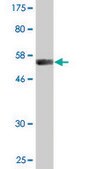 Monoclonal Anti-VWF antibody produced in mouse clone 1A11, purified immunoglobulin, buffered aqueous solution