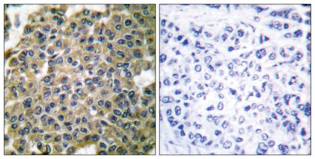Anti-Keratin 7 antibody produced in rabbit affinity isolated antibody