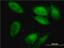 Monoclonal Anti-SARS antibody produced in mouse clone 1H4, purified immunoglobulin, buffered aqueous solution