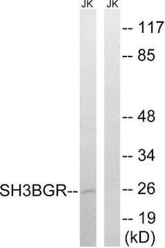 Anti-SH3BGR antibody produced in rabbit affinity isolated antibody