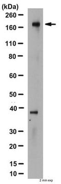 Anti-CFTR Antibody, a.a. 1370-1380, clone M3A7 clone M3A7, Chemicon&#174;, from mouse