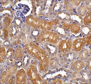 Anti-CAD antibody produced in rabbit affinity isolated antibody