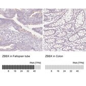 Anti-ZBBX antibody produced in rabbit Prestige Antibodies® Powered by Atlas Antibodies, affinity isolated antibody, buffered aqueous glycerol solution