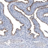 Monoclonal Anti-MUC1 antibody produced in mouse Prestige Antibodies® Powered by Atlas Antibodies, clone CL8733, purified immunoglobulin, buffered aqueous glycerol solution