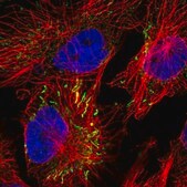 Anti-MIPEP antibody produced in rabbit Prestige Antibodies&#174; Powered by Atlas Antibodies, affinity isolated antibody, buffered aqueous glycerol solution, ab1