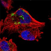 Anti-SLC25A3 antibody produced in rabbit Prestige Antibodies® Powered by Atlas Antibodies, affinity isolated antibody, buffered aqueous glycerol solution