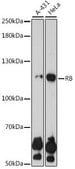 Anti- RB antibody produced in rabbit