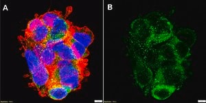 Anti-ApoB Antibody, clone MB47 ZooMAb&#174; Mouse Monoclonal recombinant, expressed in HEK 293 cells