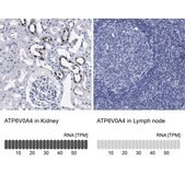 Anti-ATP6V0A4 antibody produced in rabbit Prestige Antibodies® Powered by Atlas Antibodies, affinity isolated antibody, buffered aqueous glycerol solution