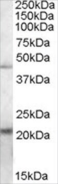 Anti-TXNDC4 antibody produced in goat affinity isolated antibody, buffered aqueous solution