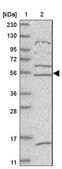Anti-ZNF232 antibody produced in rabbit Prestige Antibodies&#174; Powered by Atlas Antibodies, affinity isolated antibody, buffered aqueous glycerol solution